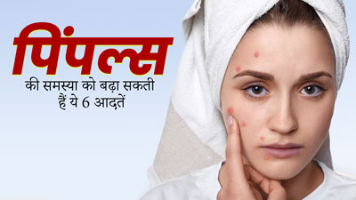  इन 6 खराब आदतों के कारण बढ़ सकती है मुंहासों की समस्या, खूबसूरत त्वचा के लिए बदलाव है जरूरी